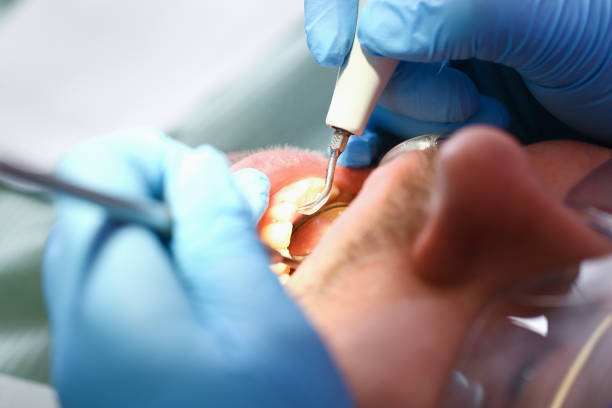 Dentist for Dental Trauma in WA